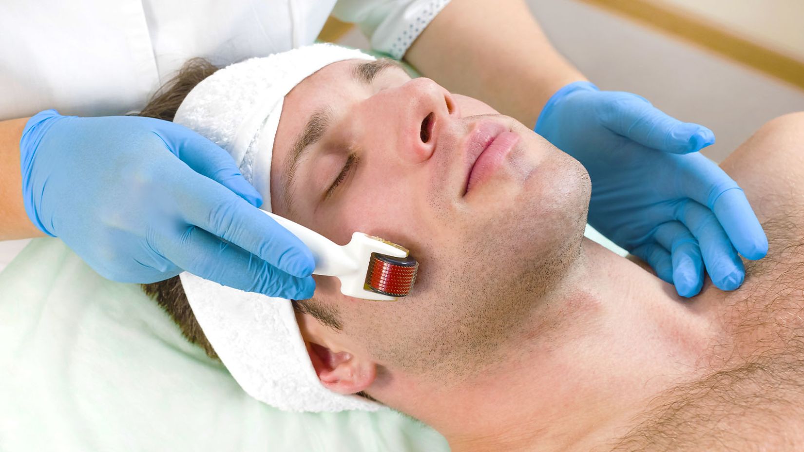 Micro Needling Facial for men at Bodyland Rotterdam